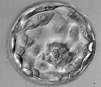 Blastocyst Transfer