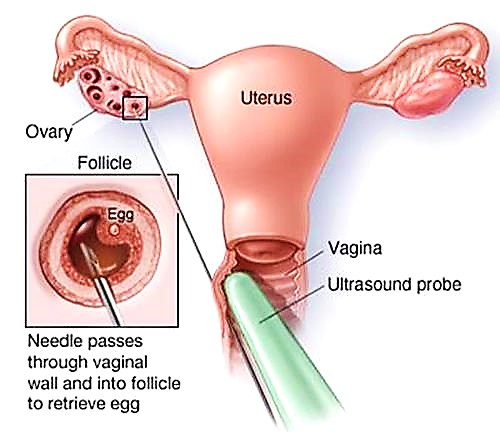 Uterus