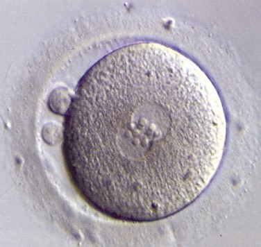 fertilized egg zygote
