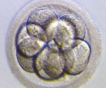 Cleavage stage embryo day 3